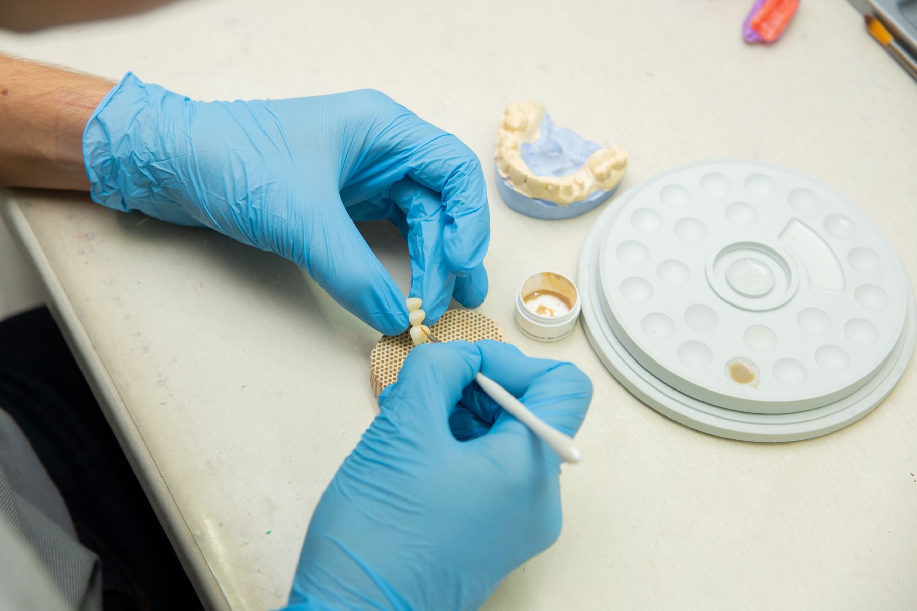 Gloved hands shaping a denture tooth by hand in a dental clinic